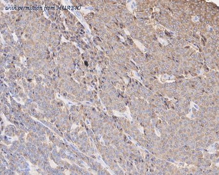 HUABIO HA601295 image 2