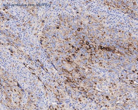 HUABIO HA601302 image 2