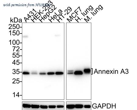 HUABIO HA601303 image 1