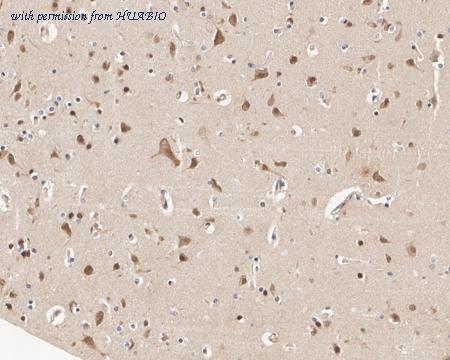 HUABIO HA601304 image 1