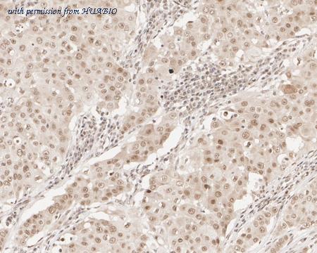 HUABIO HA601304 image 3