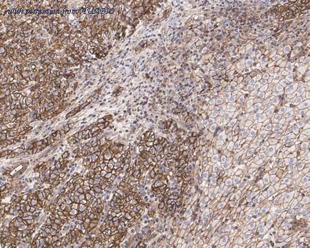 HUABIO HA601313 image 2