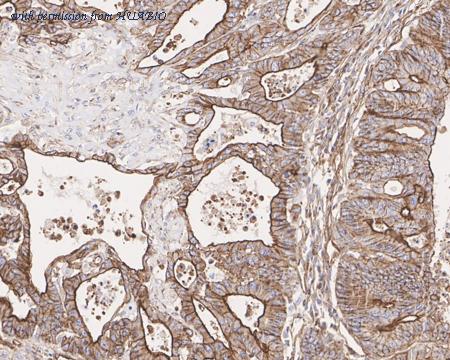 HUABIO HA601314 image 1