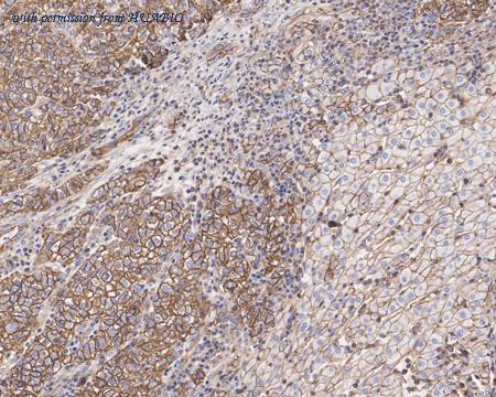 HUABIO HA601314 image 2