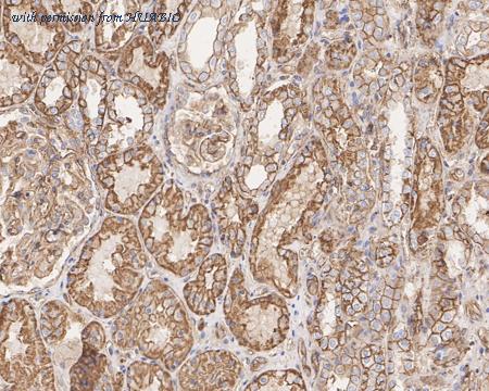 HUABIO HA601314 image 3