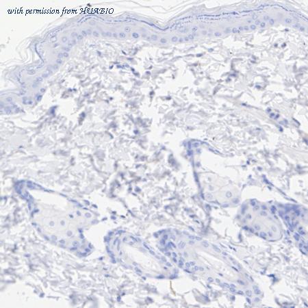 HUABIO HA601435 image 2