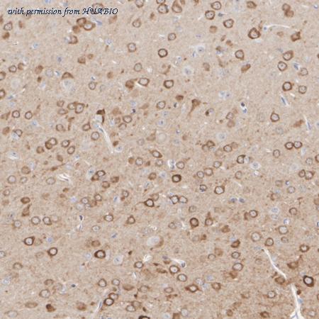 HUABIO HA601456 image 2