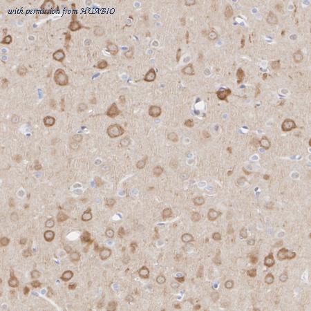 HUABIO HA601456 image 3