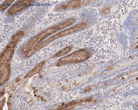 HUABIO HA610064 image 1