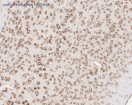 HUABIO HA610068 image 3