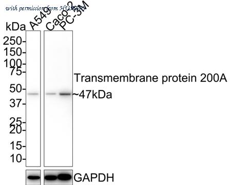 HUABIO HA610071 image 1
