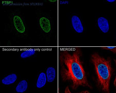 HUABIO HA610075 image 2