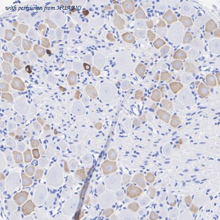 HUABIO HA610273 image 1