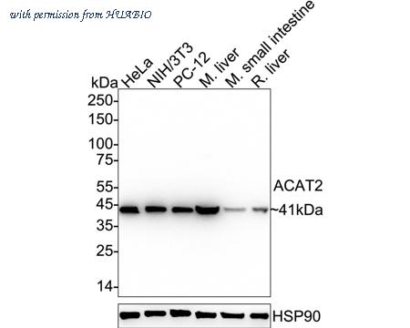 HUABIO HA720032 image 1