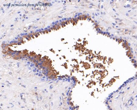 HUABIO HA720032 image 3