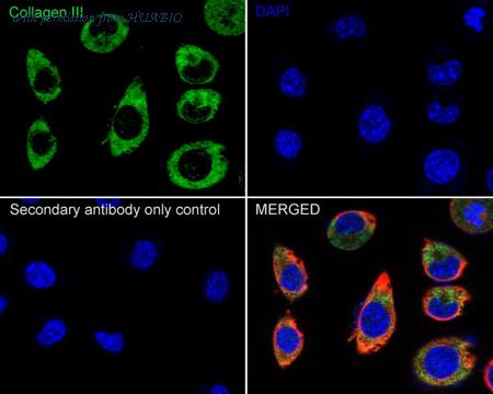 HUABIO HA720050 image 3