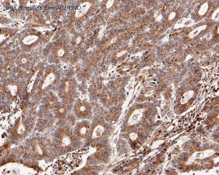 HUABIO HA720064 image 2