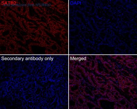 HUABIO HA720173F image 1