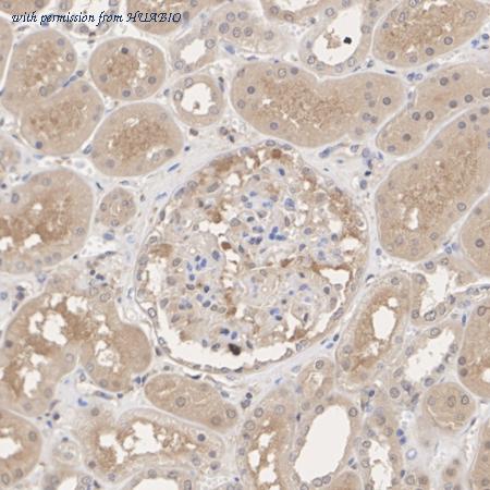 HUABIO HA721005 image 3