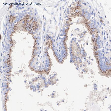 HUABIO HA721020 image 3