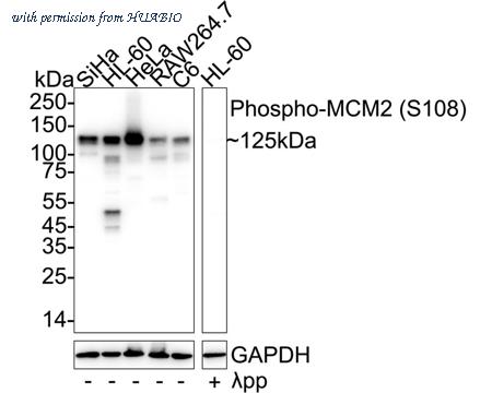 HUABIO HA721021 image 1
