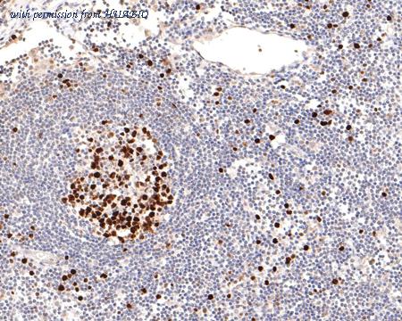 HUABIO HA721021 image 2