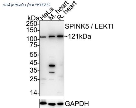 HUABIO HA721027 image 1