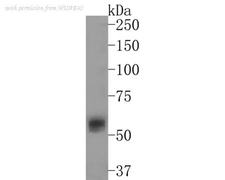 HUABIO HA721030 image 1