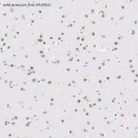 HUABIO HA721030 image 3