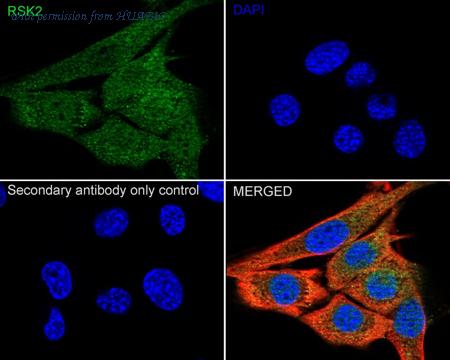 HUABIO HA721033 image 3