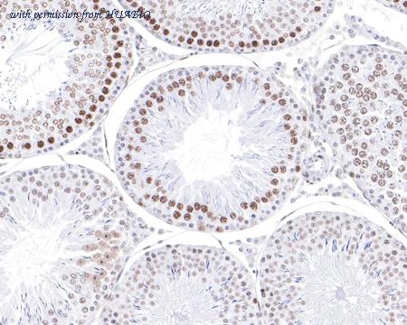 HUABIO HA721035 image 2