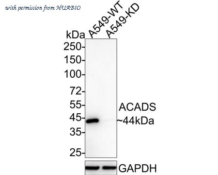 HUABIO HA721058 image 1