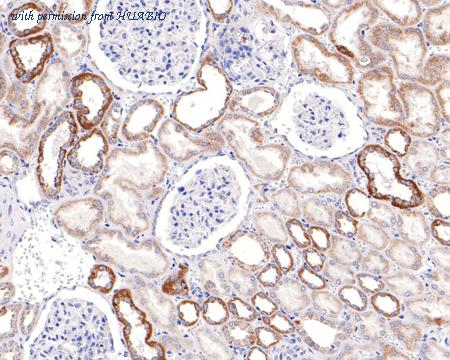 HUABIO HA721059 image 3