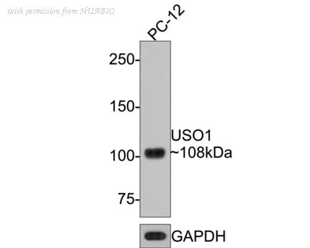 HUABIO HA721060 image 3