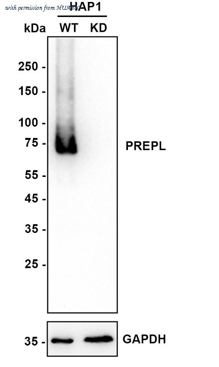 HUABIO HA721069 image 1