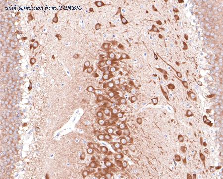 HUABIO HA721069 image 3