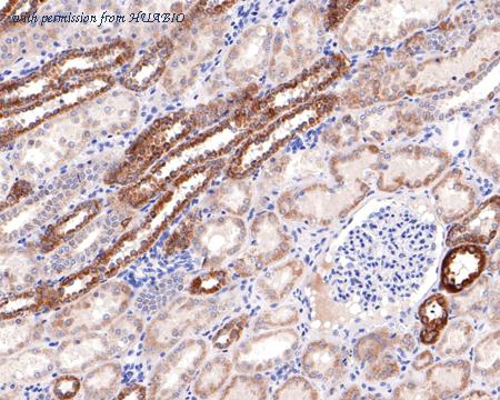 HUABIO HA721077 image 2