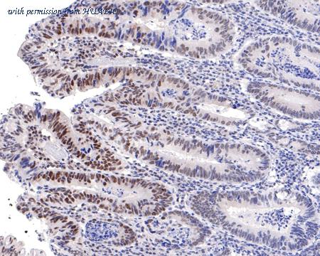 HUABIO HA721087 image 2