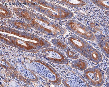 HUABIO HA721099 image 2