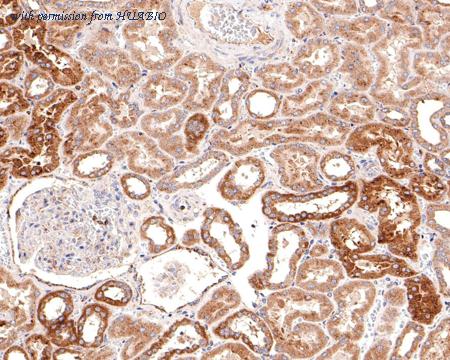 HUABIO HA721101 image 2