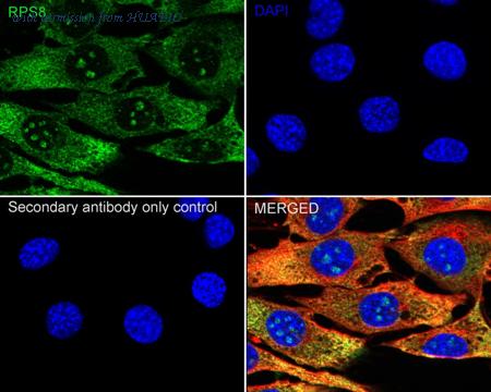 HUABIO HA721105 image 3