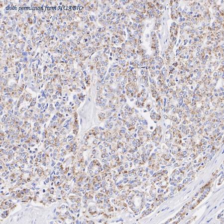 HUABIO HA721106 image 3