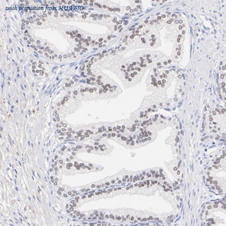 HUABIO HA721113 image 2