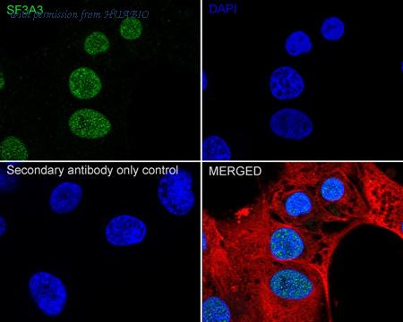 HUABIO HA721114 image 2