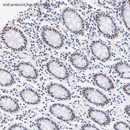 HUABIO HA721114 image 3