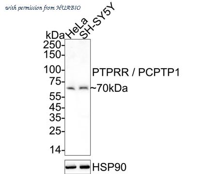 HUABIO HA721118 image 1