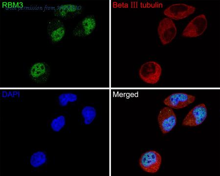 HUABIO HA721130 image 1