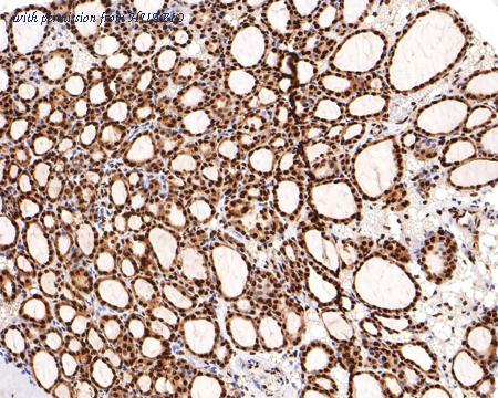 HUABIO HA721130 image 3