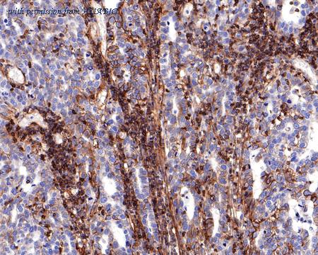 HUABIO HA721150 image 2