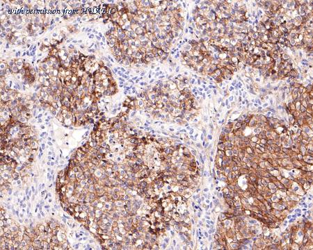 HUABIO HA721150 image 3